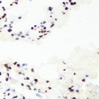 Anti-RNGTT Antibody