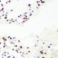 RNGTT antibody