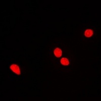 Anti-RNGTT Antibody