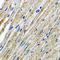 Anti-Myotilin Antibody