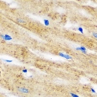 Anti-IL-18BP Antibody