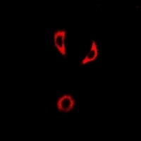 Anti-IL-18BP Antibody