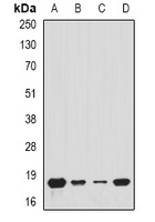 Tim17 Rabbit Polyclonal Antibody