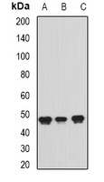 ADE2 Rabbit Polyclonal Antibody