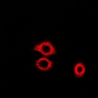 Anti-ADE2 Antibody