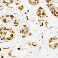 Anti-SEPHS1 Antibody