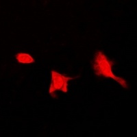 Anti-SEPHS1 Antibody
