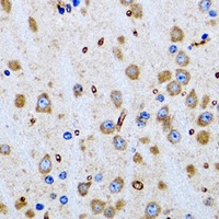 Anti-PTRH2 Antibody
