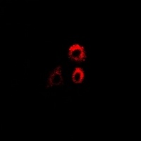 Anti-PTRH2 Antibody