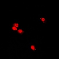 Anti-CHRAC17 Antibody
