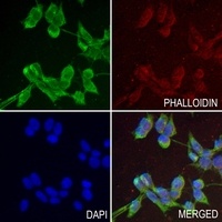 HAO1 antibody