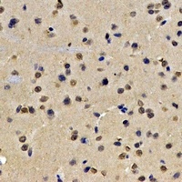 Anti-Lamin B2 Antibody