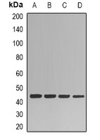 HPPDase Rabbit Polyclonal Antibody