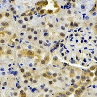 HPPDase Rabbit Polyclonal Antibody
