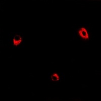 Anti-ADSS Antibody