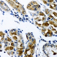 Anti-AK2 Antibody