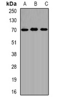 ALAS-H Rabbit Polyclonal Antibody