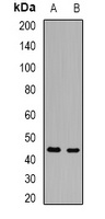 Acid Ceramidase Rabbit Polyclonal Antibody