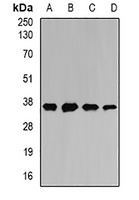 MATH-1 Rabbit Polyclonal Antibody