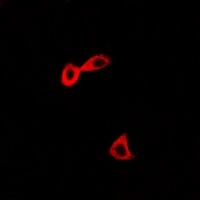 Anti-CARS Antibody