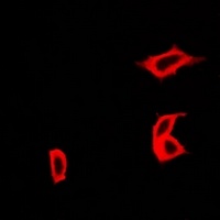 Anti-CCBL1 Antibody