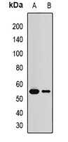 Malcavernin Antibody