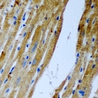 Anti-Malcavernin Antibody