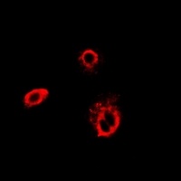 Anti-TCP1-delta Antibody