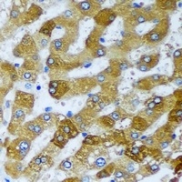 AMCase Rabbit Polyclonal Antibody