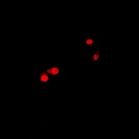 Anti-CTNNBL1 Antibody