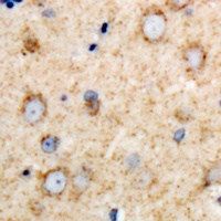 Anti-DARS Antibody
