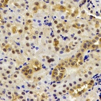 Anti-DDX1 Antibody