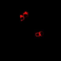 Anti-DDX1 Antibody