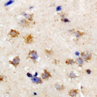 Anti-eIF2S3 Antibody
