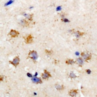 EIF2S3 antibody