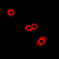 Anti-Fumarylacetoacetase Antibody