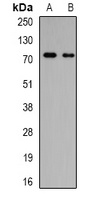 GalNAc-T3 Rabbit Polyclonal Antibody