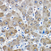 Anti-GAMT Antibody