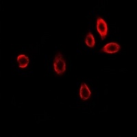 Anti-GAMT Antibody