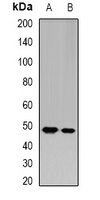AGAT Rabbit Polyclonal Antibody