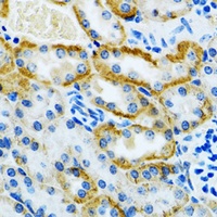 Anti-GDAP1 Antibody