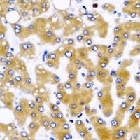 Anti-GLUD2 Antibody