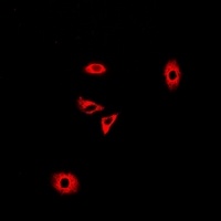 Anti-GLUD2 Antibody