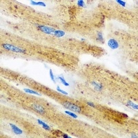 Anti-GPAM Antibody