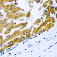 Anti-GPD2 Antibody