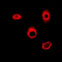 Anti-HAGH Antibody