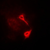 Anti-HAS3 Antibody
