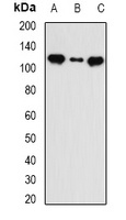 INTS5 Rabbit Polyclonal Antibody
