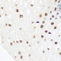 Anti-INTS5 Antibody