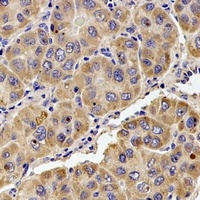 Anti-KIF1B Antibody